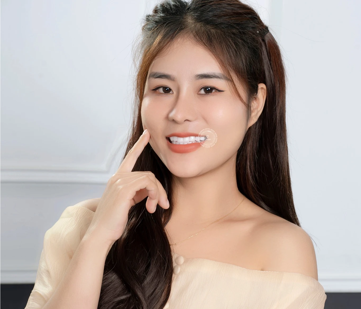 Có nên dán mặt răng sứ? Chi tiết ưu nhược điểm mà bạn nên biết